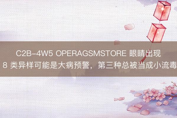 C2B-4W5 OPERAGSMSTORE 眼睛出现 8 类异样可能是大病预警，第三种总被当成小流毒